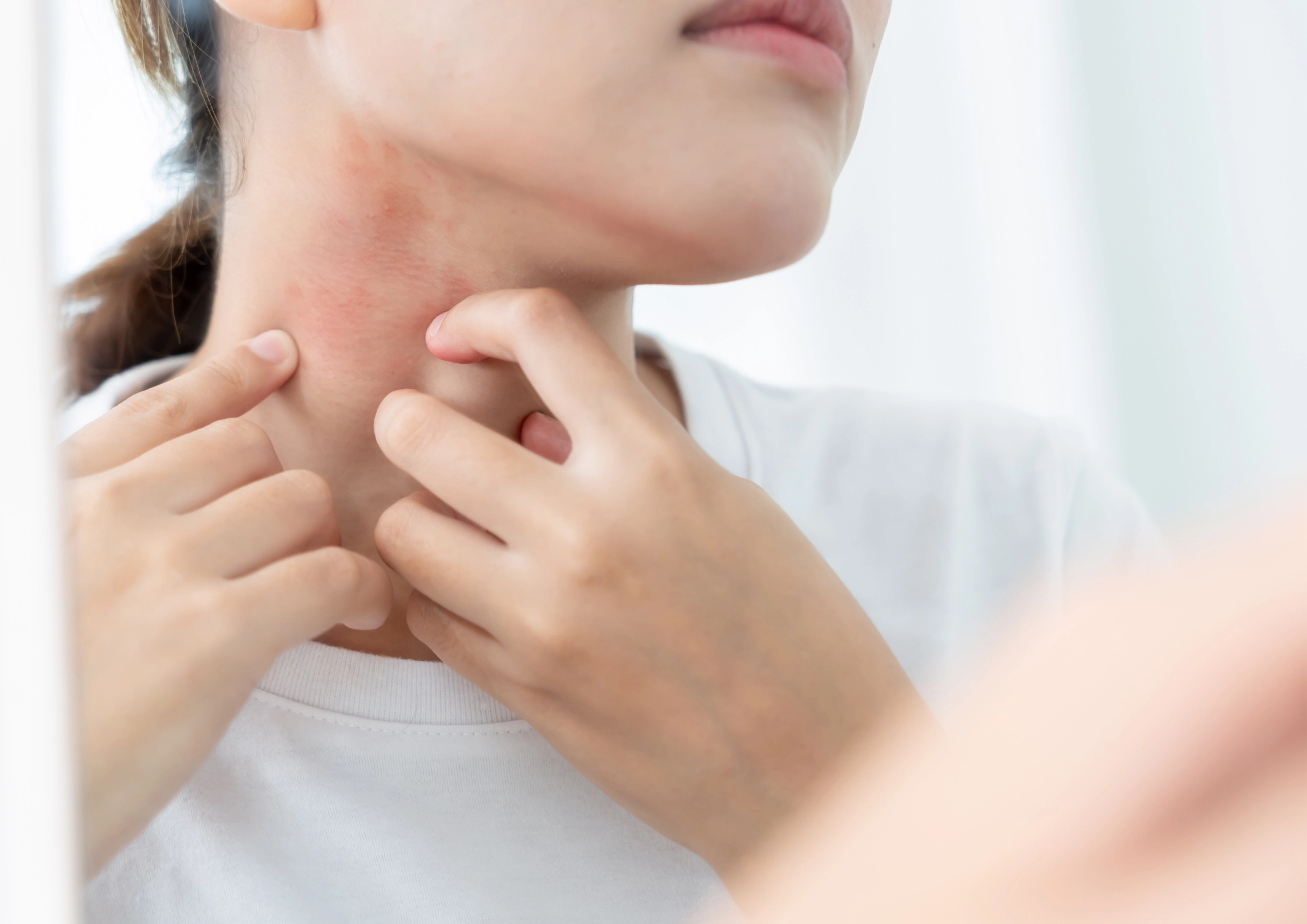 What Should You Do If You Have Sensitive Skin?
