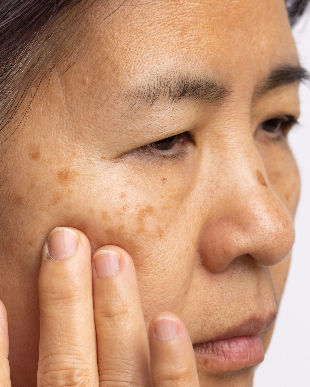 Why You Should Start Caring Before Menopause Begins